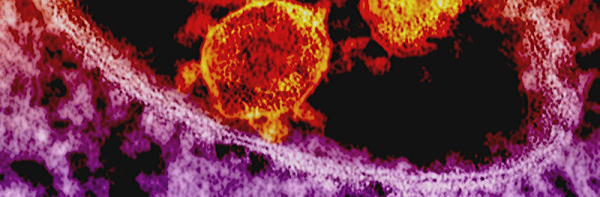 Image of COVID-19 virus