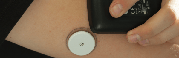 An image of a wearable continuous glucose monitor